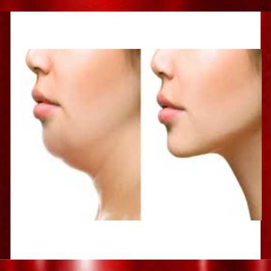 Chin Reduction Treatment